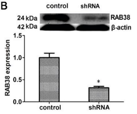 Western blot analysis results of RAB38 expression in the two different groups.jpg